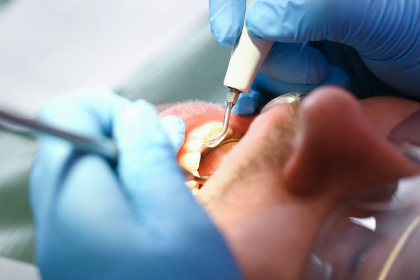 Best Emergency Dental Care for Trauma or Injury in Madison Heights, VA