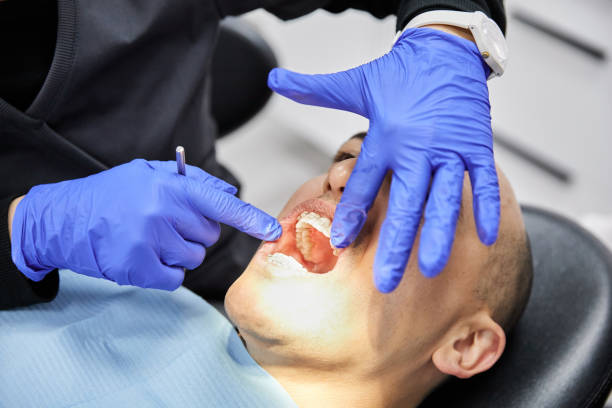 Best Emergency Broken Tooth Repair in Madison Heights, VA