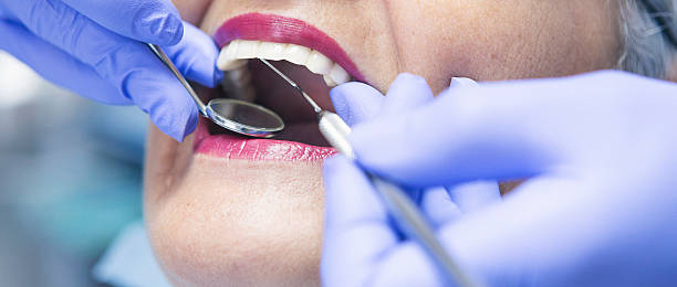 Best Emergency Treatment for Toothache in Madison Heights, VA